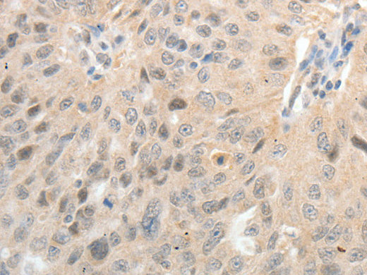 ASCL1 Polyclonal Antibody Store at -20°C, Biomarkers, Elabscience Biotechnology, MSE Supplies