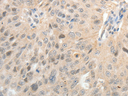 ASCL1 Polyclonal Antibody Store at -20°C, Biomarkers, Elabscience Biotechnology, MSE Supplies