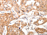 BGLAP Polyclonal Antibody Store at -20°C, Biomarkers, Elabscience Biotechnology, MSE Supplies