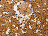JUND Polyclonal Antibody Store at -20°C, Biomarkers, Elabscience Biotechnology, MSE Supplies