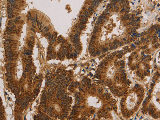 CSNK2B Polyclonal Antibody Store at -20°C, Biomarkers, Elabscience Biotechnology, MSE Supplies