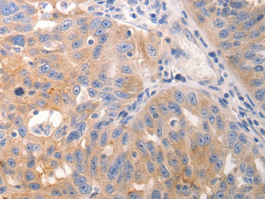 CK-6A/B/C Polyclonal Antibody Store at -20°C, Biomarkers, Elabscience Biotechnology, MSE Supplies