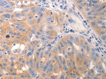 CK-6A/B/C Polyclonal Antibody Store at -20°C, Biomarkers, Elabscience Biotechnology, MSE Supplies