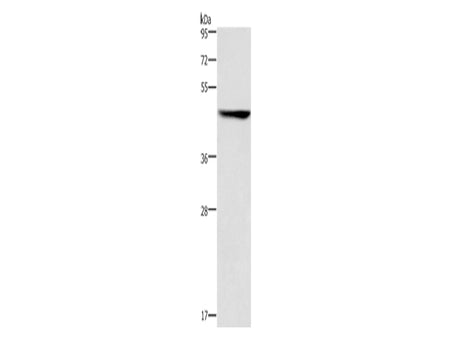 CK-16 Polyclonal Antibody Store at -20°C, Biomarkers, Elabscience Biotechnology, MSE Supplies