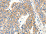 COL4A1 Polyclonal Antibody Store at -20°C, Biomarkers, Elabscience Biotechnology, MSE Supplies