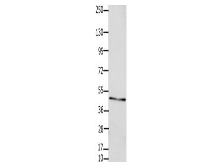 Connexin 47 Polyclonal Antibody Store at -20°C, Biomarkers, Elabscience Biotechnology, MSE Supplies