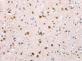 NDUFA12 Polyclonal Antibody Store at -20°C, Biomarkers, Elabscience Biotechnology, MSE Supplies