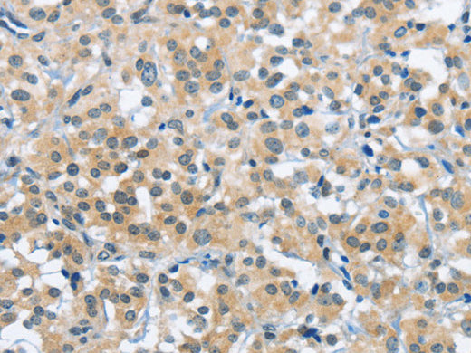 TRDMT1 Polyclonal Antibody Store at -20°C, Biomarkers, Elabscience Biotechnology, MSE Supplies