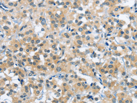 TRDMT1 Polyclonal Antibody Store at -20°C, Biomarkers, Elabscience Biotechnology, MSE Supplies