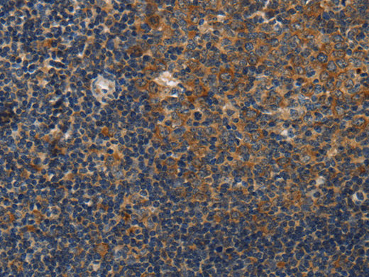 DSP Polyclonal Antibody Store at -20°C, Biomarkers, Elabscience Biotechnology, MSE Supplies