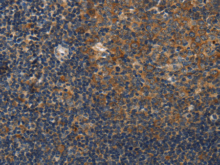 DSP Polyclonal Antibody Store at -20°C, Biomarkers, Elabscience Biotechnology, MSE Supplies