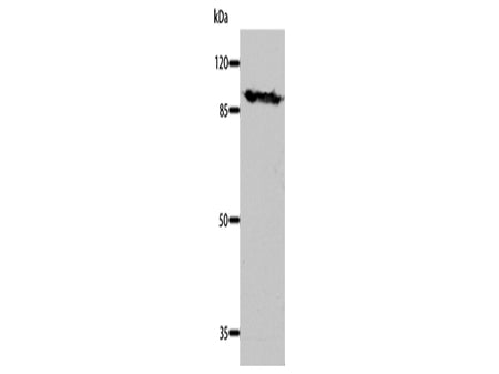 DNM1 Polyclonal Antibody Store at -20°C, Biomarkers, Elabscience Biotechnology, MSE Supplies