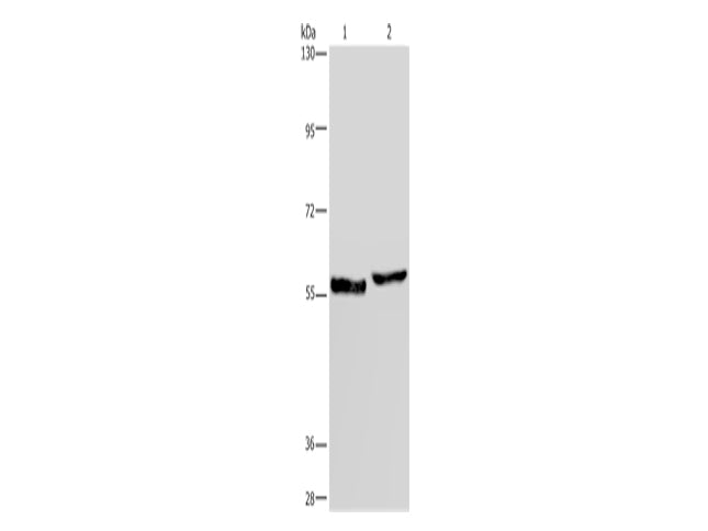 SLC1A6 Polyclonal Antibody Store at -20°C, Biomarkers, Elabscience Biotechnology, MSE Supplies