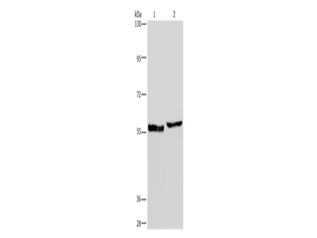 SLC1A6 Polyclonal Antibody Store at -20°C, Biomarkers, Elabscience Biotechnology, MSE Supplies