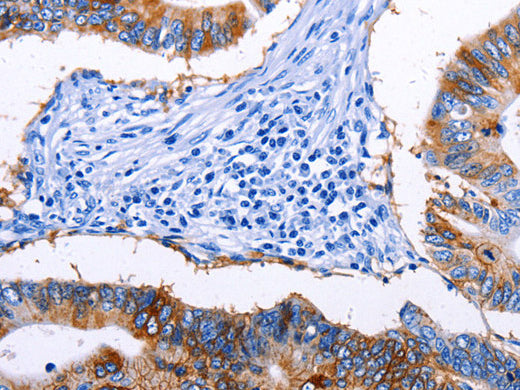 EPCAM Polyclonal Antibody Store at -20°C, Biomarkers, Elabscience Biotechnology, MSE Supplies