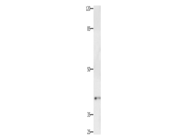 PTGER1 Polyclonal Antibody Store at -20°C, Biomarkers, Elabscience Biotechnology, MSE Supplies