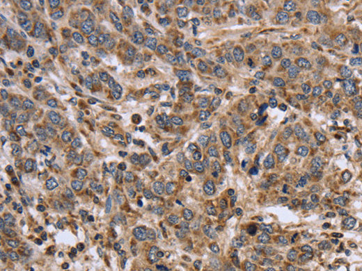 EPOR Polyclonal Antibody Store at -20°C, Biomarkers, Elabscience Biotechnology, MSE Supplies