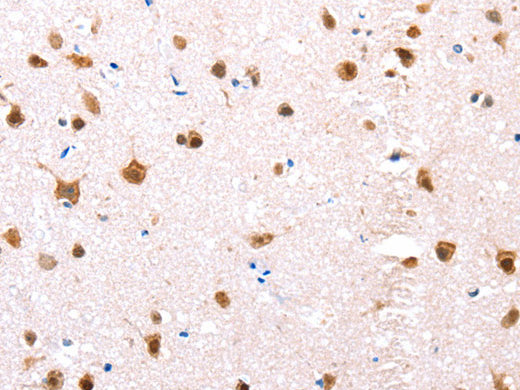ER Alpha Polyclonal Antibody Store at -20°C, Biomarkers, Elabscience Biotechnology, MSE Supplies
