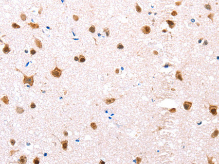 ER Alpha Polyclonal Antibody Store at -20°C, Biomarkers, Elabscience Biotechnology, MSE Supplies