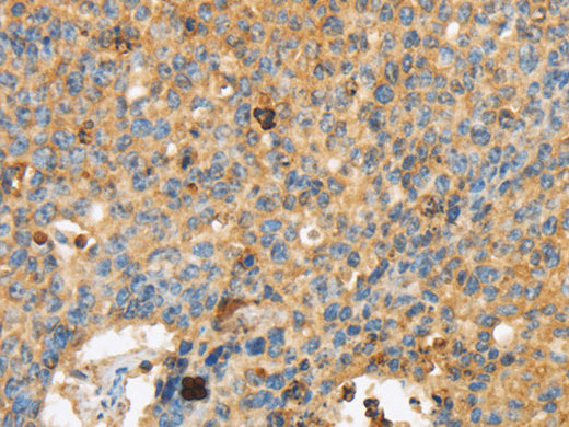 ERK 3 Polyclonal Antibody Store at -20°C, Biomarkers, Elabscience Biotechnology, MSE Supplies