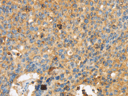 ERK 3 Polyclonal Antibody Store at -20°C, Biomarkers, Elabscience Biotechnology, MSE Supplies