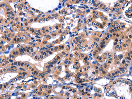 FBN1 Polyclonal Antibody Store at -20°C, Biomarkers, Elabscience Biotechnology, MSE Supplies