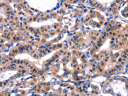 FBN1 Polyclonal Antibody Store at -20°C, Biomarkers, Elabscience Biotechnology, MSE Supplies