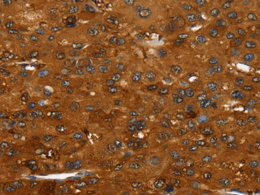 FGFR3 Polyclonal Antibody Store at -20°C, Biomarkers, Elabscience Biotechnology, MSE Supplies