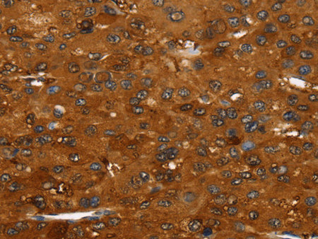 FGFR3 Polyclonal Antibody Store at -20°C, Biomarkers, Elabscience Biotechnology, MSE Supplies