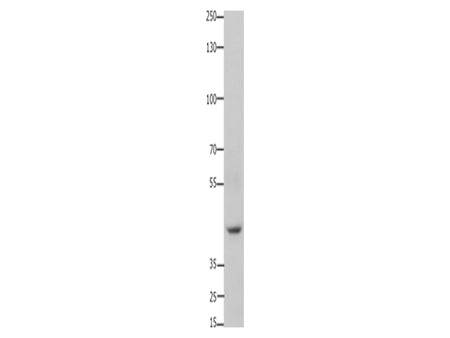 FOXD3 Polyclonal Antibody Store at -20°C, Biomarkers, Elabscience Biotechnology, MSE Supplies