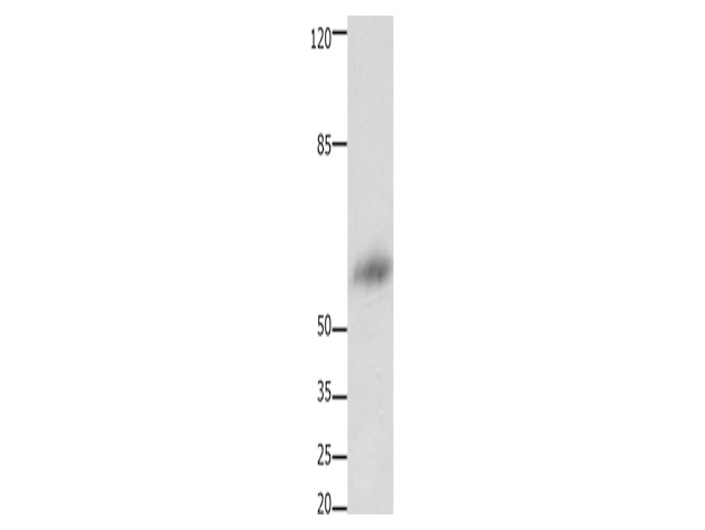 FOXJ3 Polyclonal Antibody Store at -20°C, Biomarkers, Elabscience Biotechnology, MSE Supplies