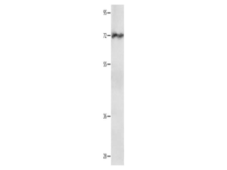 IGF2BP1 Polyclonal Antibody Store at -20°C, Biomarkers, Elabscience Biotechnology, MSE Supplies