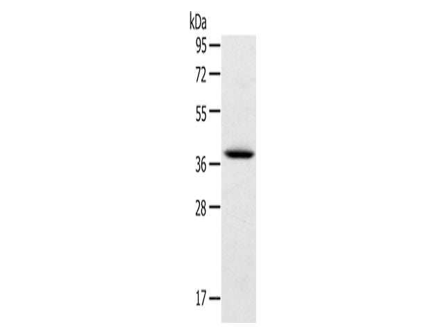 TPM2 Polyclonal Antibody Store at -20°C, Biomarkers, Elabscience Biotechnology, MSE Supplies