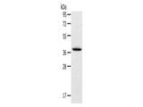 TPM2 Polyclonal Antibody Store at -20°C, Biomarkers, Elabscience Biotechnology, MSE Supplies