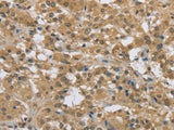 PKD1 Polyclonal Antibody Store at -20°C, Biomarkers, Elabscience Biotechnology, MSE Supplies