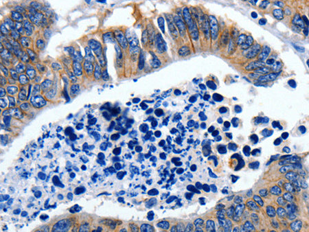 GAD2 Polyclonal Antibody Store at -20°C, Biomarkers, Elabscience Biotechnology, MSE Supplies