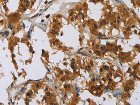 GATA5 Polyclonal Antibody Store at -20°C, Biomarkers, Elabscience Biotechnology, MSE Supplies