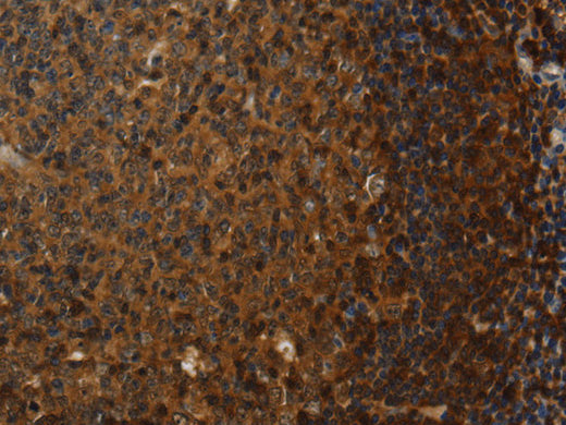 Claudin 8 Polyclonal Antibody Store at -20°C, Biomarkers, Elabscience Biotechnology, MSE Supplies