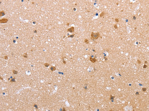 Claudin 10 Polyclonal Antibody Store at -20°C, Biomarkers, Elabscience Biotechnology, MSE Supplies
