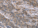 GSN Polyclonal Antibody Store at -20°C, Biomarkers, Elabscience Biotechnology, MSE Supplies