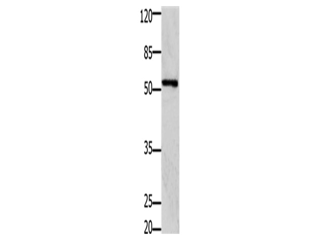 GFRA1 Polyclonal Antibody Store at -20°C, Biomarkers, Elabscience Biotechnology, MSE Supplies