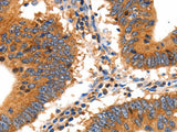 SLC2A2 Polyclonal Antibody Store at -20°C, Biomarkers, Elabscience Biotechnology, MSE Supplies