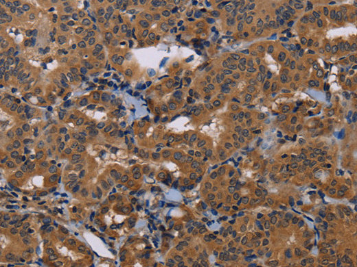 GRK1 Polyclonal Antibody Store at -20°C, Biomarkers, Elabscience Biotechnology, MSE Supplies