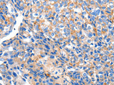 HCN2 Polyclonal Antibody Store at -20°C, Biomarkers, Elabscience Biotechnology, MSE Supplies
