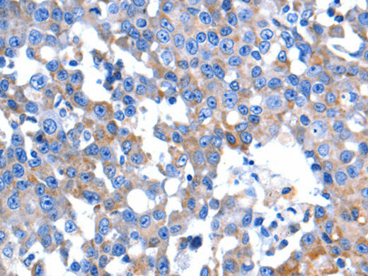 HINT2 Polyclonal Antibody Store at -20°C, Biomarkers, Elabscience Biotechnology, MSE Supplies