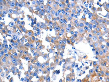 HINT2 Polyclonal Antibody Store at -20°C, Biomarkers, Elabscience Biotechnology, MSE Supplies