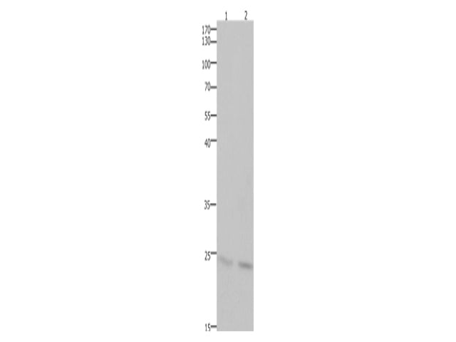 HMGB3 Polyclonal Antibody Store at -20°C, Biomarkers, Elabscience Biotechnology, MSE Supplies