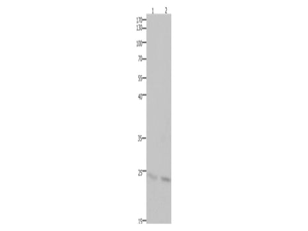 HMGB3 Polyclonal Antibody Store at -20°C, Biomarkers, Elabscience Biotechnology, MSE Supplies