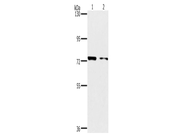 PPP1R13L Polyclonal Antibody Store at -20°C, Biomarkers, Elabscience Biotechnology, MSE Supplies