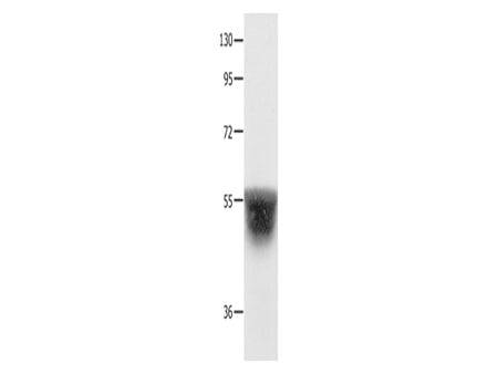 KCNA1 Polyclonal Antibody Store at -20°C, Biomarkers, Elabscience Biotechnology, MSE Supplies